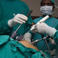 Χειρουργική Απώλεια Βάρους | Δρ. Δαρδαμάνης Δημήτριος